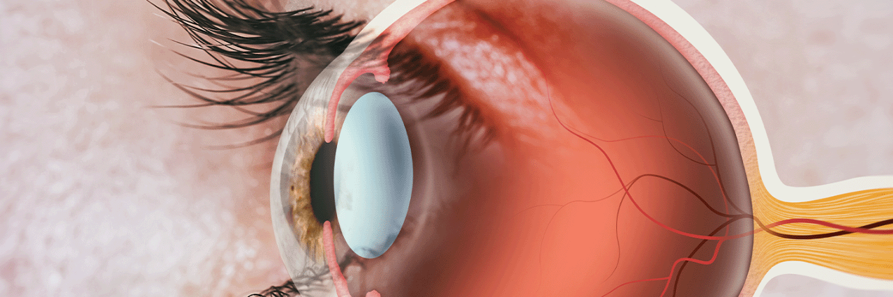 Retina_titulo01