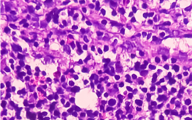 ldcbg2