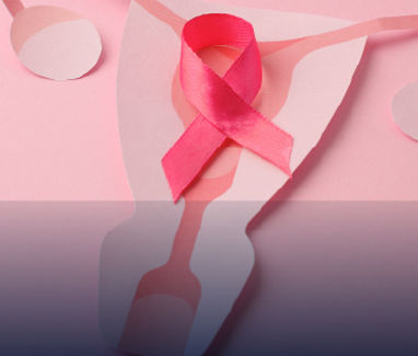CancerOvario1