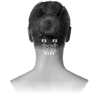  NAKKENS PARASPINALE MUSKLER