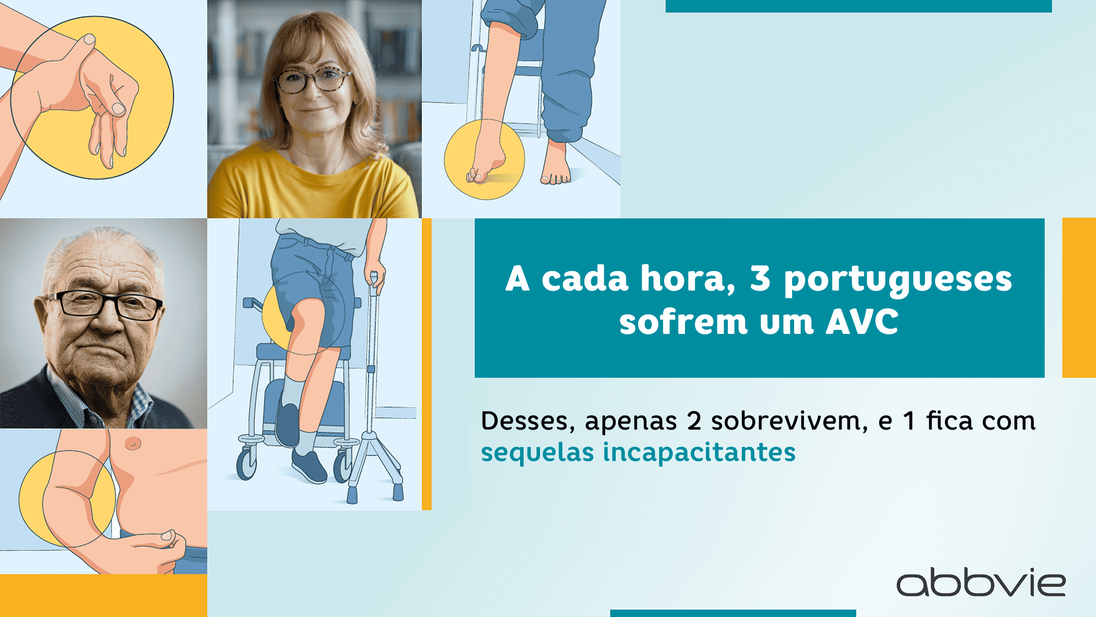 Referenciação Espasticidade pós-AVC