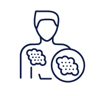 Atopik Dermatit Konuşalım