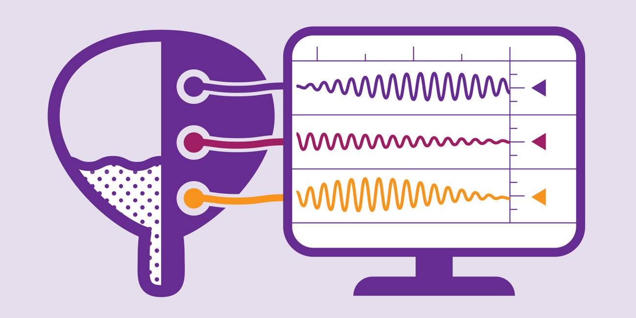Bladder_Data Bladder_Data